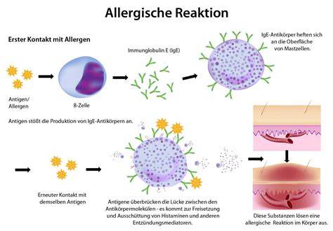 Allergische Reaktion auf Honigbestandteile