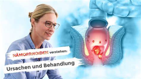 Anatomische Grafik: Aufbau und Funktion von Hämorrhoiden