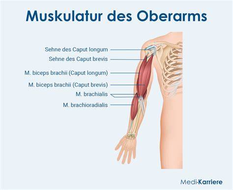 Anlegung eines CGM-Sensors am Oberarm