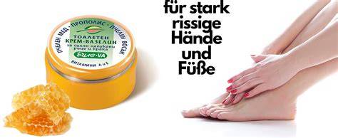 Anwendungsmöglichkeiten von Propolis-Salben: Hände, Gesicht, Füße