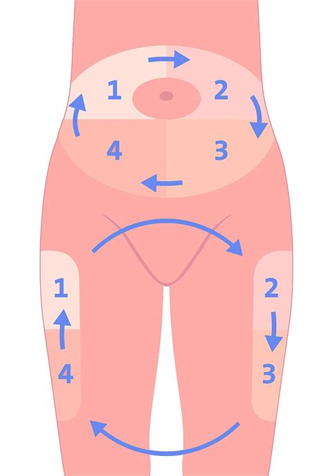 Bauch mit markierten Injektionszonen und Spritzschema