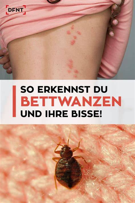 Bettwanzen erkennen und bekämpfen: Marzipangeruch, Blutflecke, Biss-Straßen