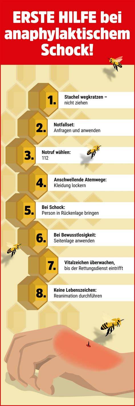 Bienenstich Vergleichstabelle Infografik