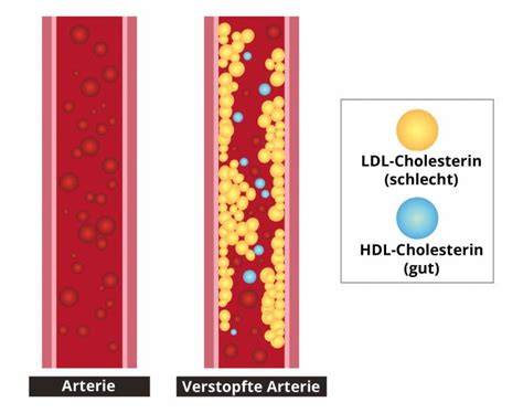 Cholesterin: Wirkung im Blut und Zusammenspiel von LDL und HDL
