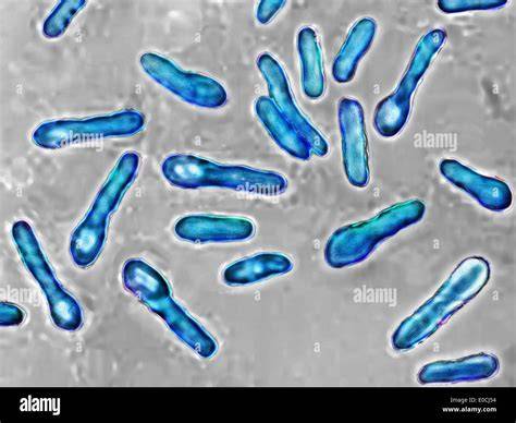 Clostridium botulinum Bakterium unter dem Mikroskop