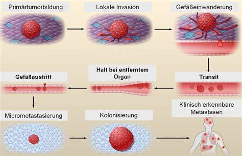 Diagramm: Tumorrate und Metastasierung bei Zuckergabe vs. Stärke (Mäusemodell)
