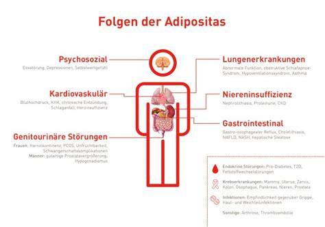 Die Folgen von Adipositas: Überblick (Infografik)