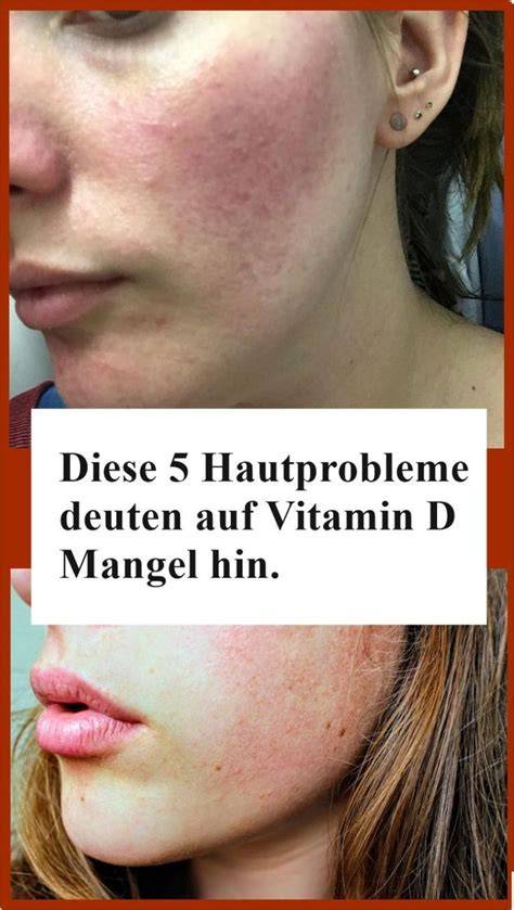 Effekte auf Haut durch Vitamin C und Honig