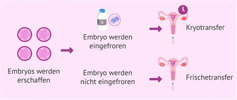Eine schematische Grafik zum Embryotransfer und Ernährung nach IVF