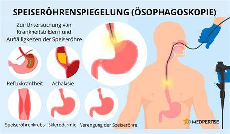 Endoskopiebild der Speiseröhre bei eosinophiler Ösophagitis mit typischen Entzündungszeichen