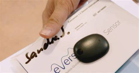 Eversense implantierbarer Sensor: Einsetzen und Funktionsweise