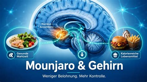 Fett-Zucker-Kombination: Belohnungszentrum im Gehirn