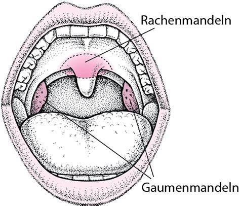 Gaumenmandeln und Rachen - Schematische Darstellung