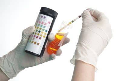 Glukosurie: Ausscheidung von Glucose im Urin