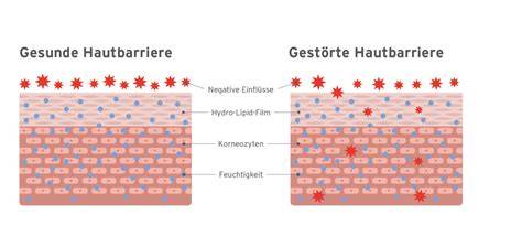 Grafik: Hautbarriere bei Ekzem mit und ohne Honig-Anwendung