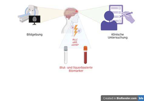 Grafik: Individualisierte Blutzuckerreaktionen