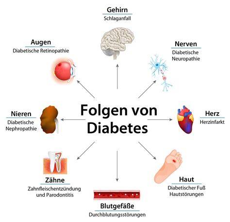 Grafik: Komplikationen von Diabetes bei älteren Menschen (Auge, Niere, Nerven, Gefäße, Fuß)