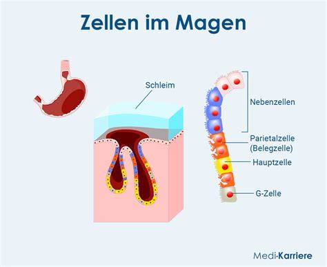 Grafik Magenschleimhaut, Gastritis und Magensäure