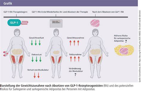 Grafik zur Häufigkeit und Art der Nebenwirkungen von GLP-1-Rezeptoragonisten