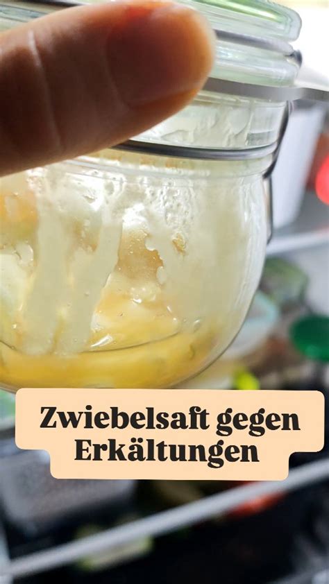 Hausmittel bei Insektenstichen: Zwiebel, Quark, Essig, Honig, ätherische Öle