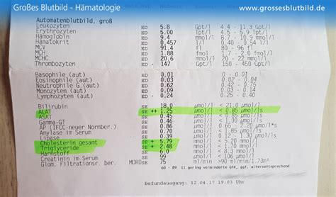 HbA1c-Laborbefund mit angedeuteten Prozentsätzen und mmol/mol Angaben