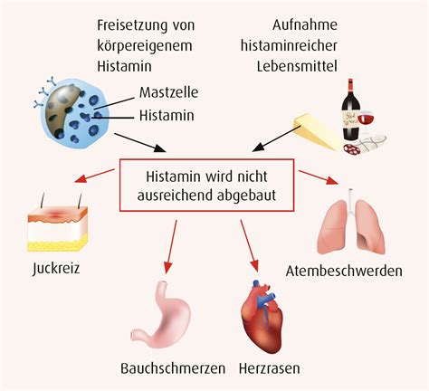 Histaminintoleranz Diagnostik und Behandlungsschema