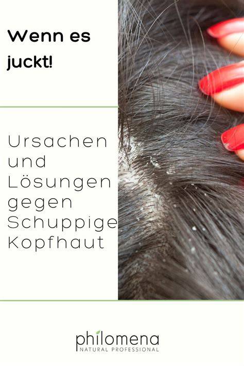 Honig schützt gegen Schuppen und pflegt die Kopfhaut