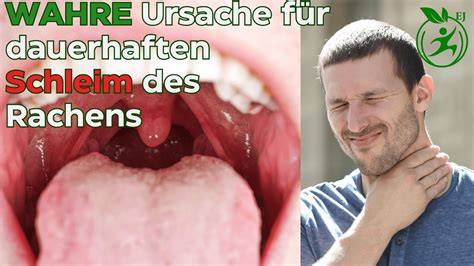 Honig-Wirkstoffe und Wirkung auf Schleimhäute