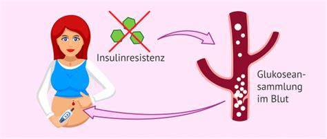 Illustration: Insulin-Pen für die Behandlung von Schwangerschaftsdiabetes