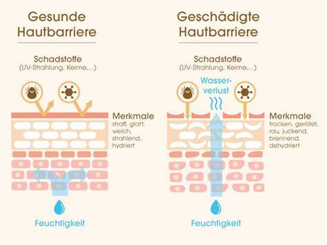 Illustration: trockene Hautbarriere und Juckreiz-Mechanismen