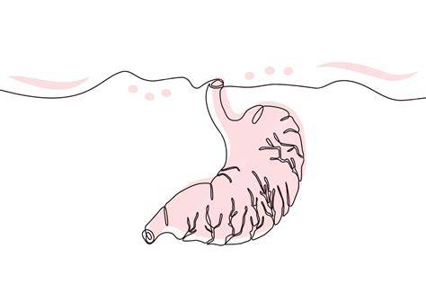 Illustration Schleudergussverfahren und flache Relief‑Form