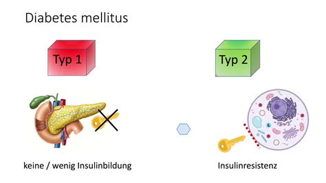 Illustration Typ-1 vs Typ-2 bei Kindern
