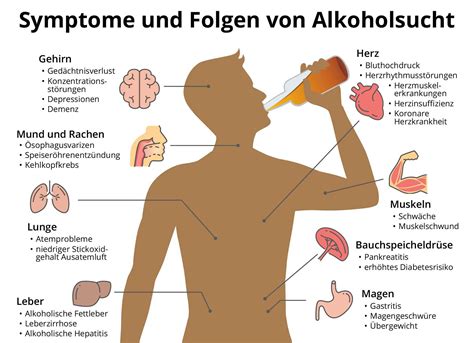 Infografik: Alkohol und Diabetes im Alltag