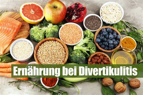 Infografik: Ballaststoffreiche Ernährung bei Divertikulitis