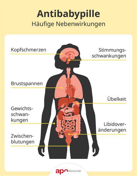 Infografik: Häufige und seltene Nebenwirkungen nach Kategorien