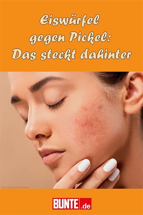 Infografik: Honigpeeling gegen Pickel