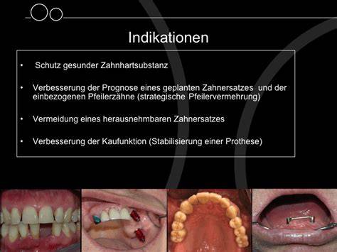 Infografik: Indikationen, Kontraindikationen und Portionierung von Milkraft