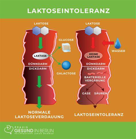 Infografik: Laktose in Milchprodukten und Laktoseintoleranz