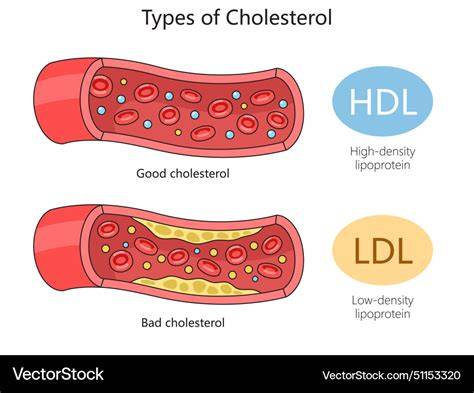 Infografik: Lipoproteintransport - LDL vs HDL