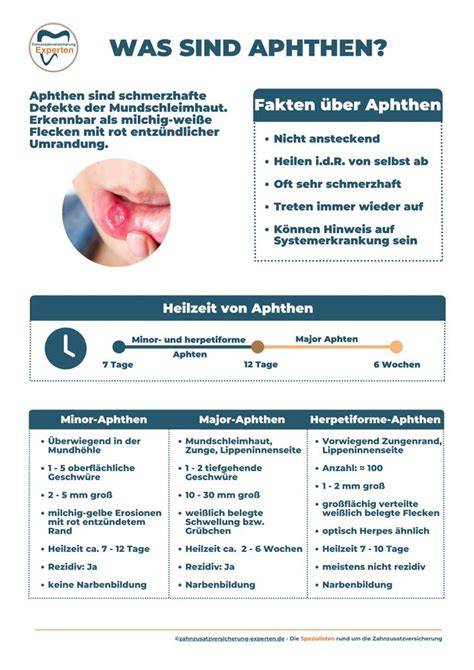 Infografik: So beugt man Aphthen im Mund vor