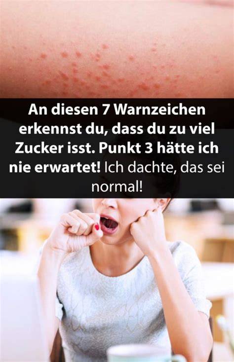 Infografik: Verlauf der Symptome beim Zuckerentzug