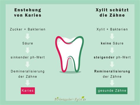 Infografik: Wie Xylit gegen Karies wirkt