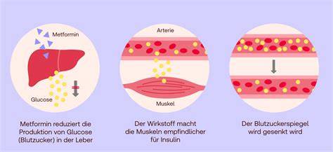 Infografik: Wirkorte von Metformin (Leber, Muskel, Darm) und typische GI-Nebenwirkungen