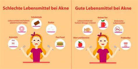 Infografik: Zusammenhang zwischen Ernährung, Lebensstilfaktoren und Akne