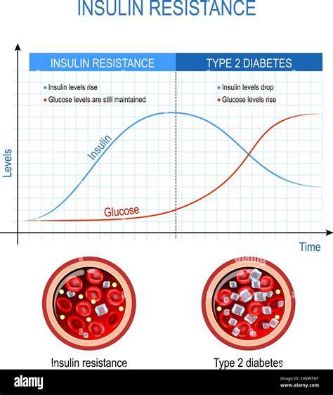 Insulinresistenz und Blutzuckerspiegel bei Diabetes Typ 2
