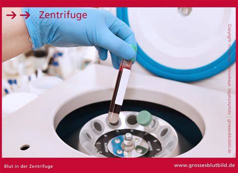 Kristallisierung und Trennung in der Zentrifuge