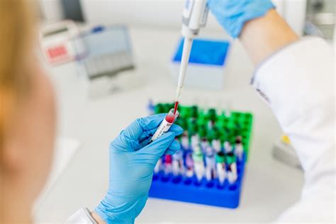 Laboruntersuchung: Probenanalyse Dubai-Schokolade
