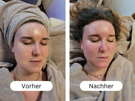 Lippenstiftfleck auf Kleidung vor und nach der Behandlung