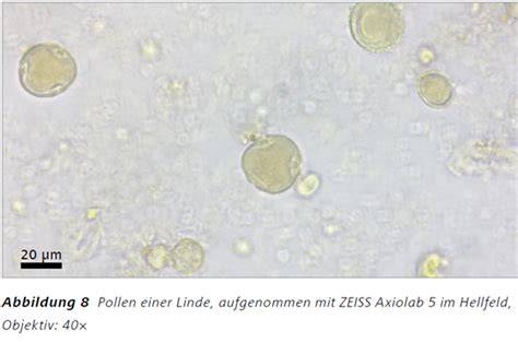 Mikroskopische Darstellung von Pollen und Enzymen im Honig