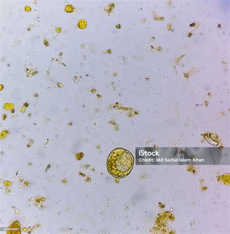 Präparierte Honigprobe mit Pollen für die mikroskopische Untersuchung